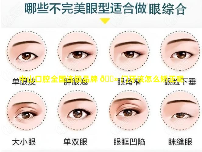 中山口腔全国连锁品牌 🌻 门牙该怎么矫正呢